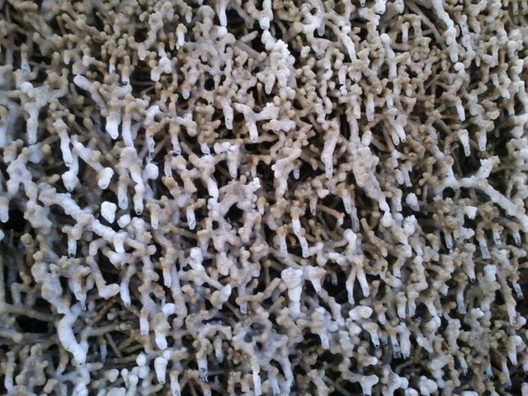 Understanding Aortic Calcification: Causes & Treatment