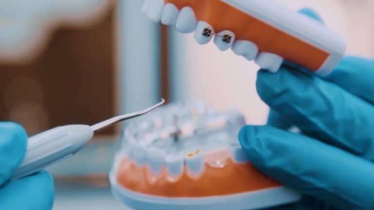 Get Straight Talk with Farina Orthodontics: A Gappy Tale