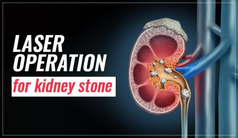 Find Expert Urologist in Las Vegas for Comprehensive Care