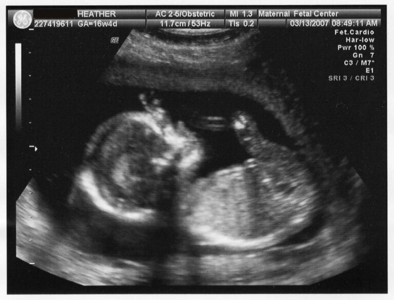 Can Ultrasound Detect Cancer? Exploring the Possibilities