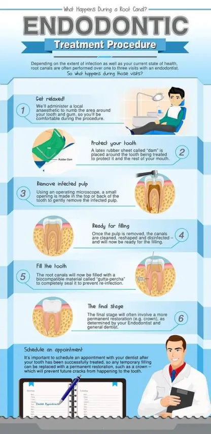 Root Canal Relief: Say Goodbye to the Pain!