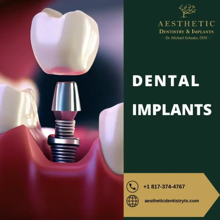 Dental Cleaning Cost Without Insurance: A Guide
