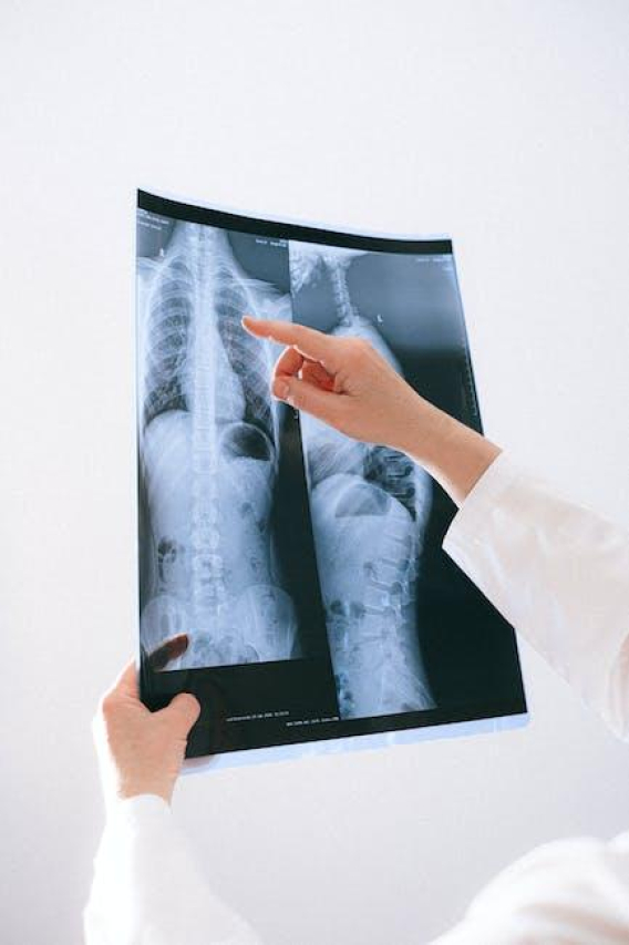 X-Ray Costs: What to Expect for Your Medical Imaging