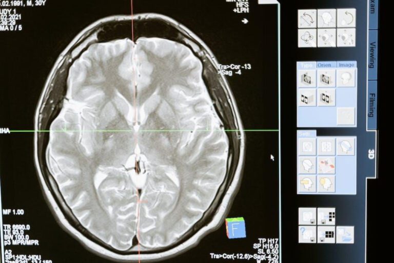 Breaking the Bank: MRI Scan Costs Uninsured