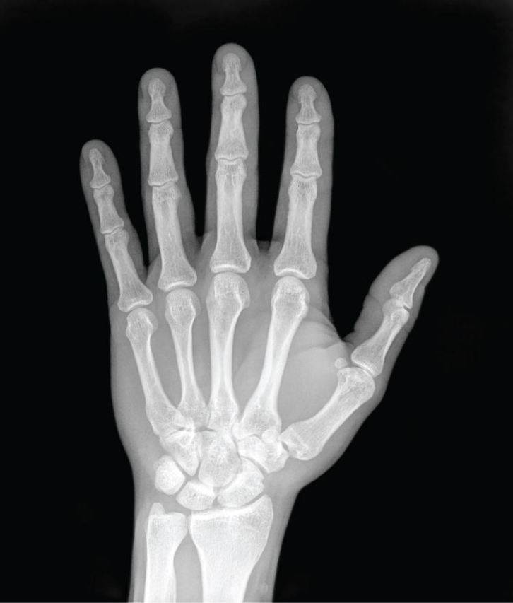 X-Ray Price Tag: Is It Worth the Exposure?