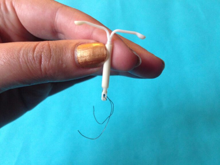 The Pricey Truth: How Much Does an IUD Cost?