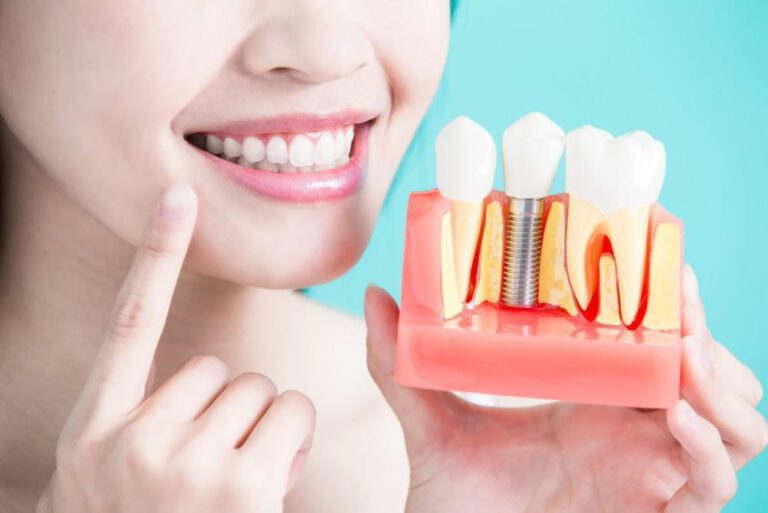 Chew on This: The Price Tag of Gum Grafting!