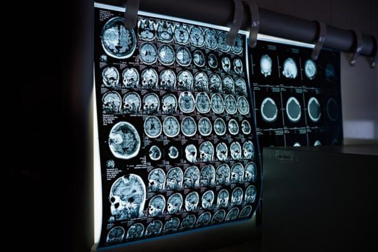 Understanding the Average Cost of an MRI: What You Need to Know