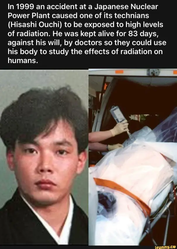 The Tragic Story of Hisashi Ouchi: Skin Falling Off