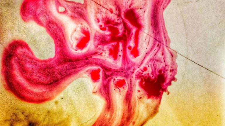 The Potential Side Effects of Nobivac Canine 1-DAPPV: What You Need to Know