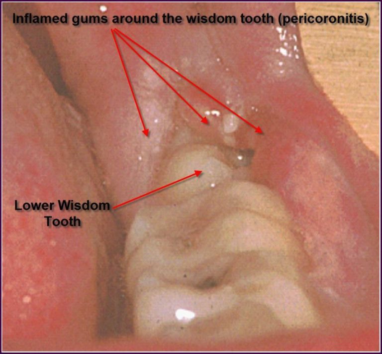 Understanding Swollen Gums in Dogs: Causes and Treatment